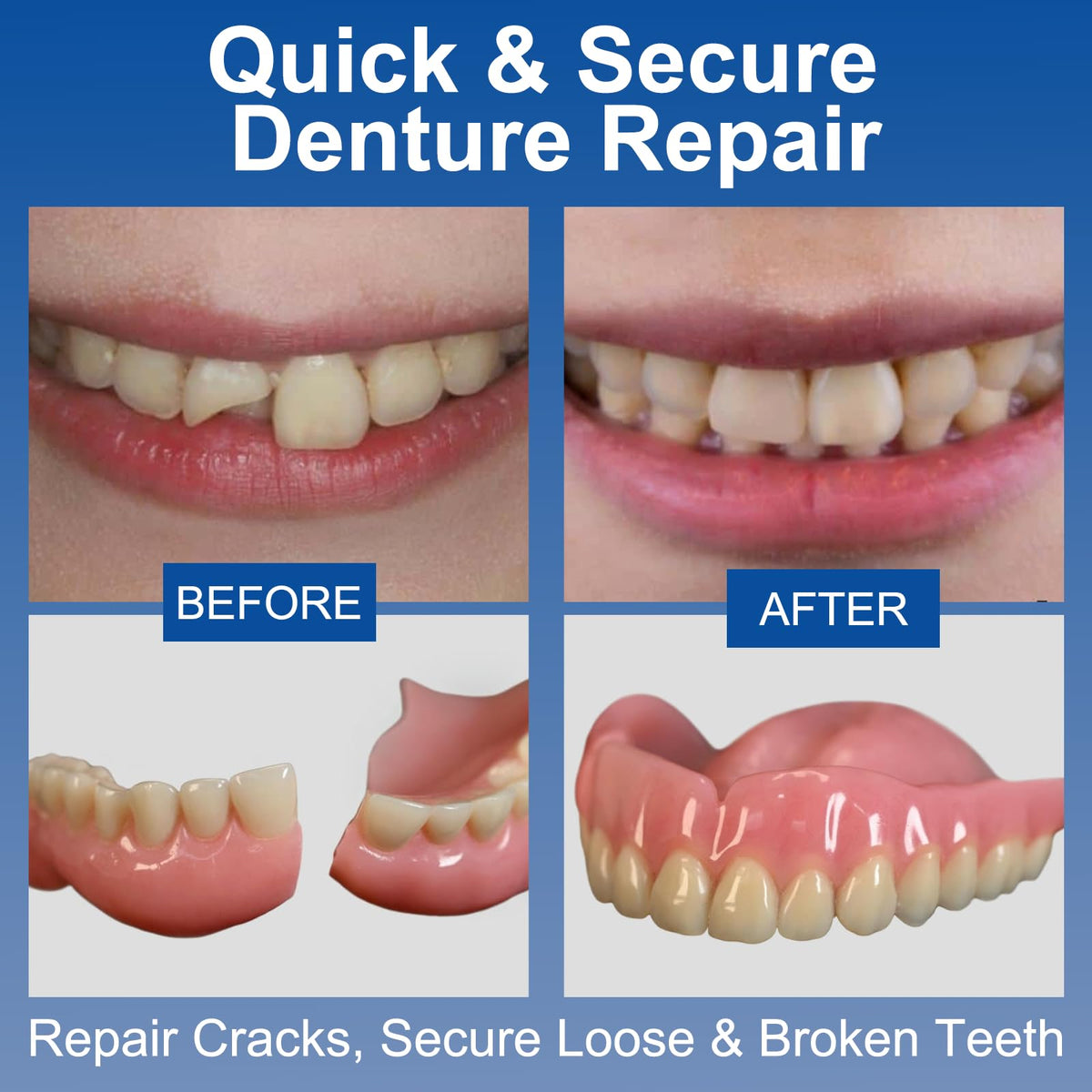 1 oz Clear Dental Bonding Glue M24778